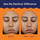 PanOxyl Acne Clearing Spot Treatment, Target Acne Pimples with Maximum Strength 10% Benzoyl Peroxide, Sooth Skin with Allantoin and Bisabolol, Lock in