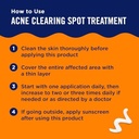 PanOxyl Acne Clearing Spot Treatment, Target Acne Pimples with Maximum Strength 10% Benzoyl Peroxide, Sooth Skin with Allantoin and Bisabolol, Lock in