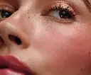 freckle3.webp